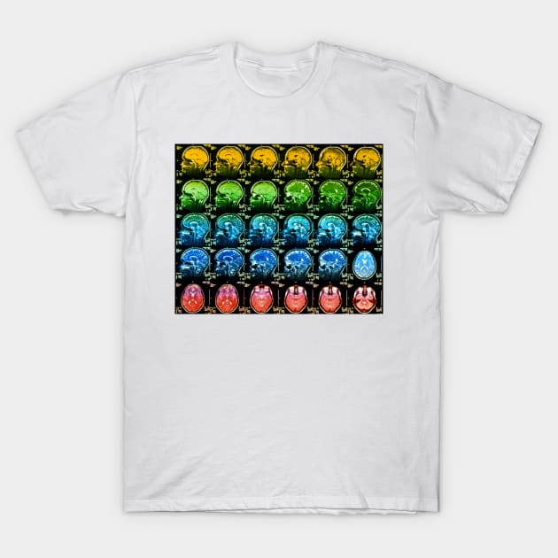 Coloured MRI scans of a healthy human brain (P332/0331) T-Shirt by SciencePhoto